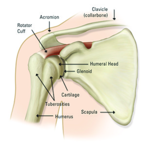 torn rotator cuff